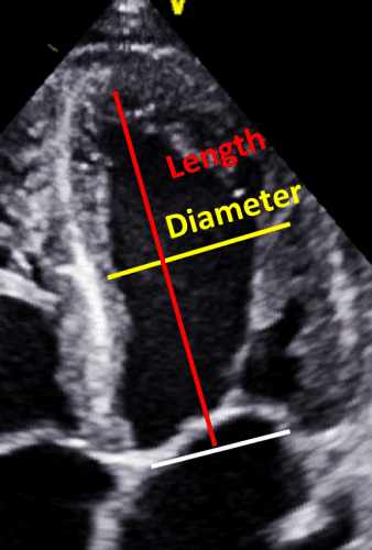 ef e1563901289823 - LV EF (area length-method)